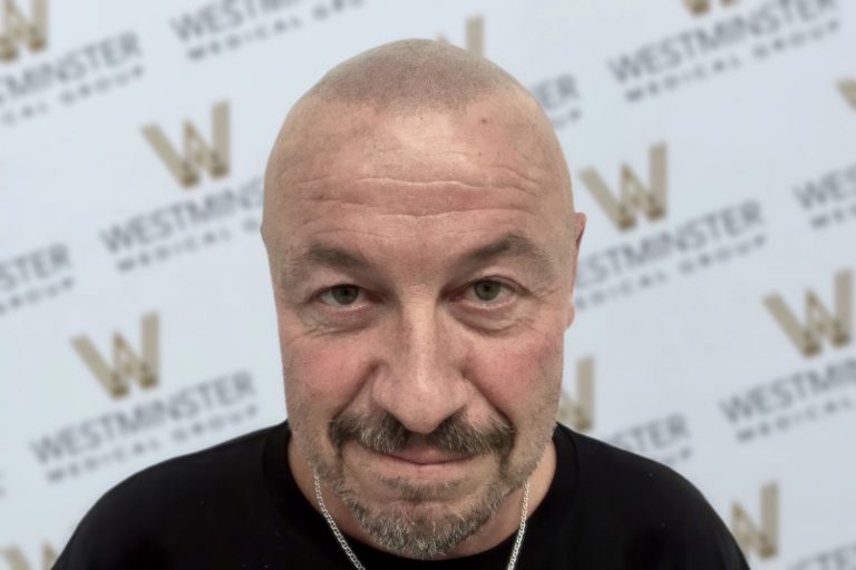 A close-up portrait of a smiling man with hair regrowth and a goatee, standing in front of a backdrop with the 'westminster' logo repeated. He's looking directly at the camera.