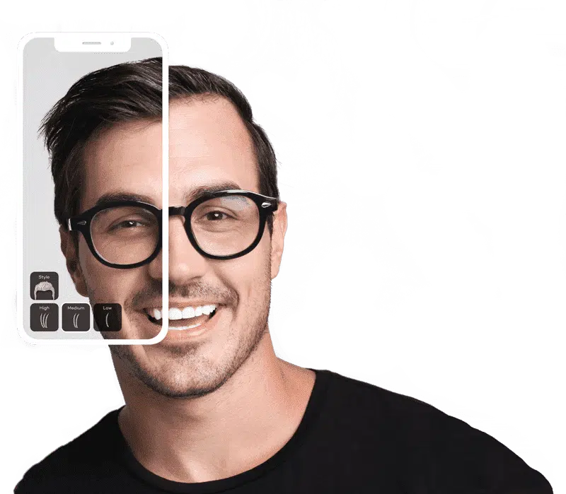 hair transplant uk