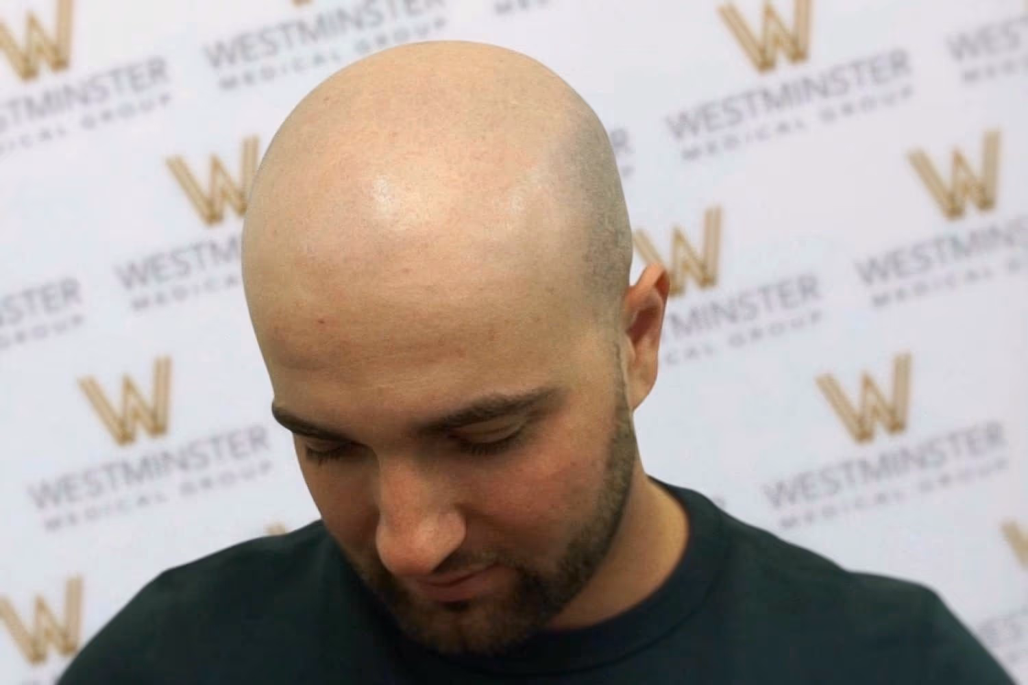 A man with male pattern baldness and a beard, dressed in a green shirt, looking downward in front of a background with repeated "Westminster" logos.