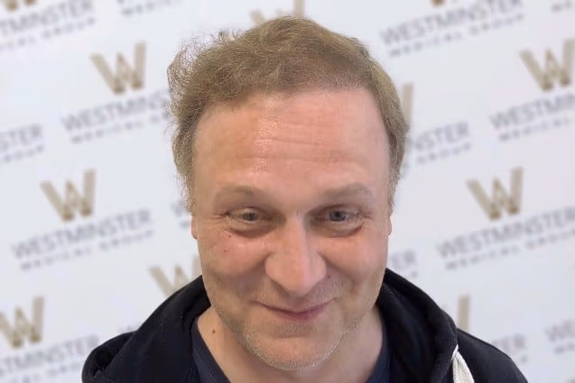 A middle-aged man with light skin and meticulously implanted light brown hair smiles gently at the camera. He's in front of a backdrop featuring a logo with repeated "W" icons. He wears a dark