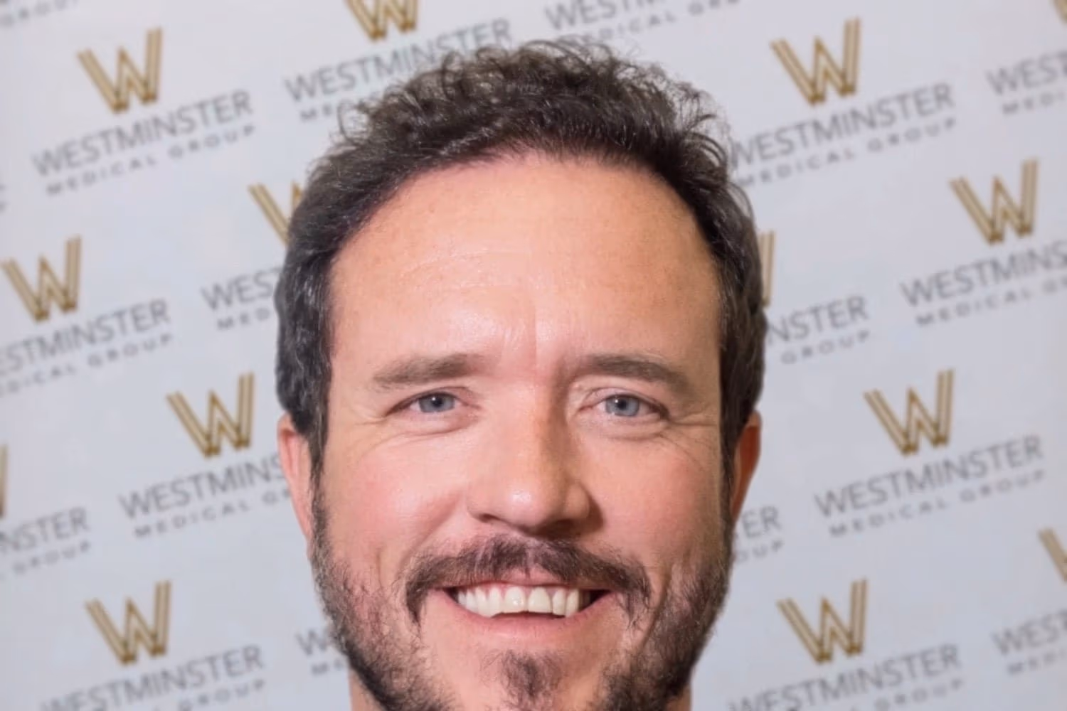 hair transplant london