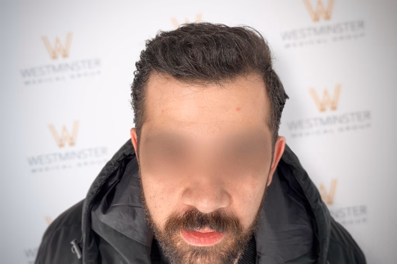 A blurred photo of a man with his face obscured, focusing on his curly hair, against a background with a repeating "westminster" logo. He is wearing a white shirt and displaying signs of early