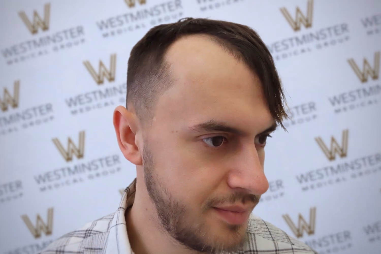 A close-up of a young man with an unusual haircut featuring shaved sides and disconnected longer hair on top, possibly due to male pattern baldness, sitting in front of a backdrop with a Westminster logo pattern