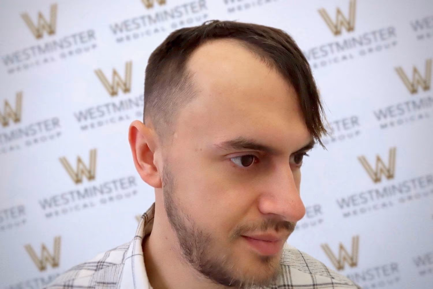 A man with a distinct side-parted undercut hairstyle, looking to the side in front of a background with the repeated "westminster" logo following his recent hair surgery.
