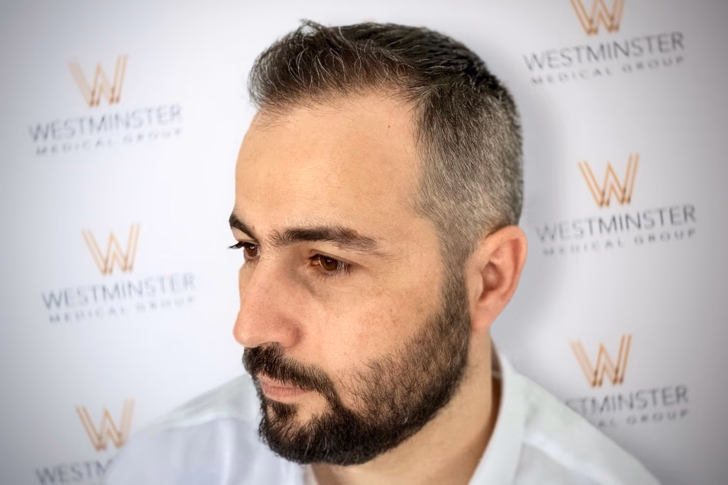 A man with a meticulously groomed beard and short hair stands before a backdrop featuring the Westminster Medical Group logo, focusing thoughtfully to his left, representing their hair transplant services.