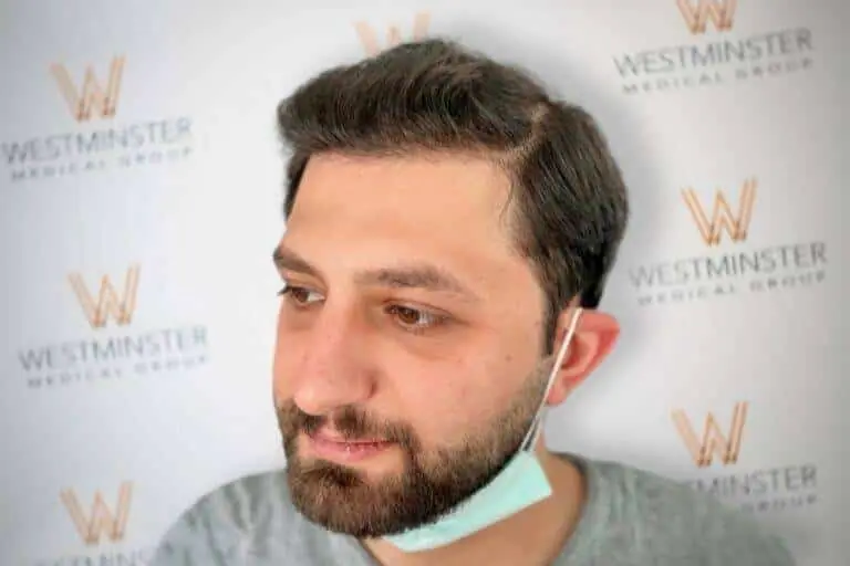 Close-up portrait of a man with a beard and a face mask pulled down to his chin, standing in front of a backdrop with the "Westminster Medical Group" logo, specializing in hair implant treatments