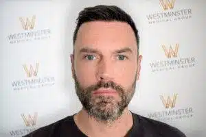 Frontal view of a bearded male patient with dense hair coverage showcasing Hair Transplant Cost London outcomes